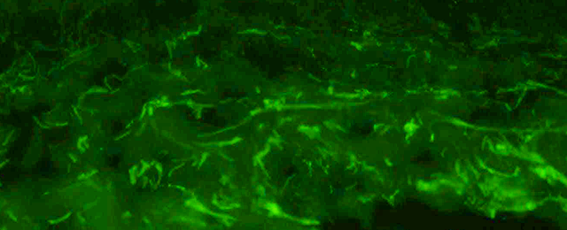 Sin tratamiento + Polución