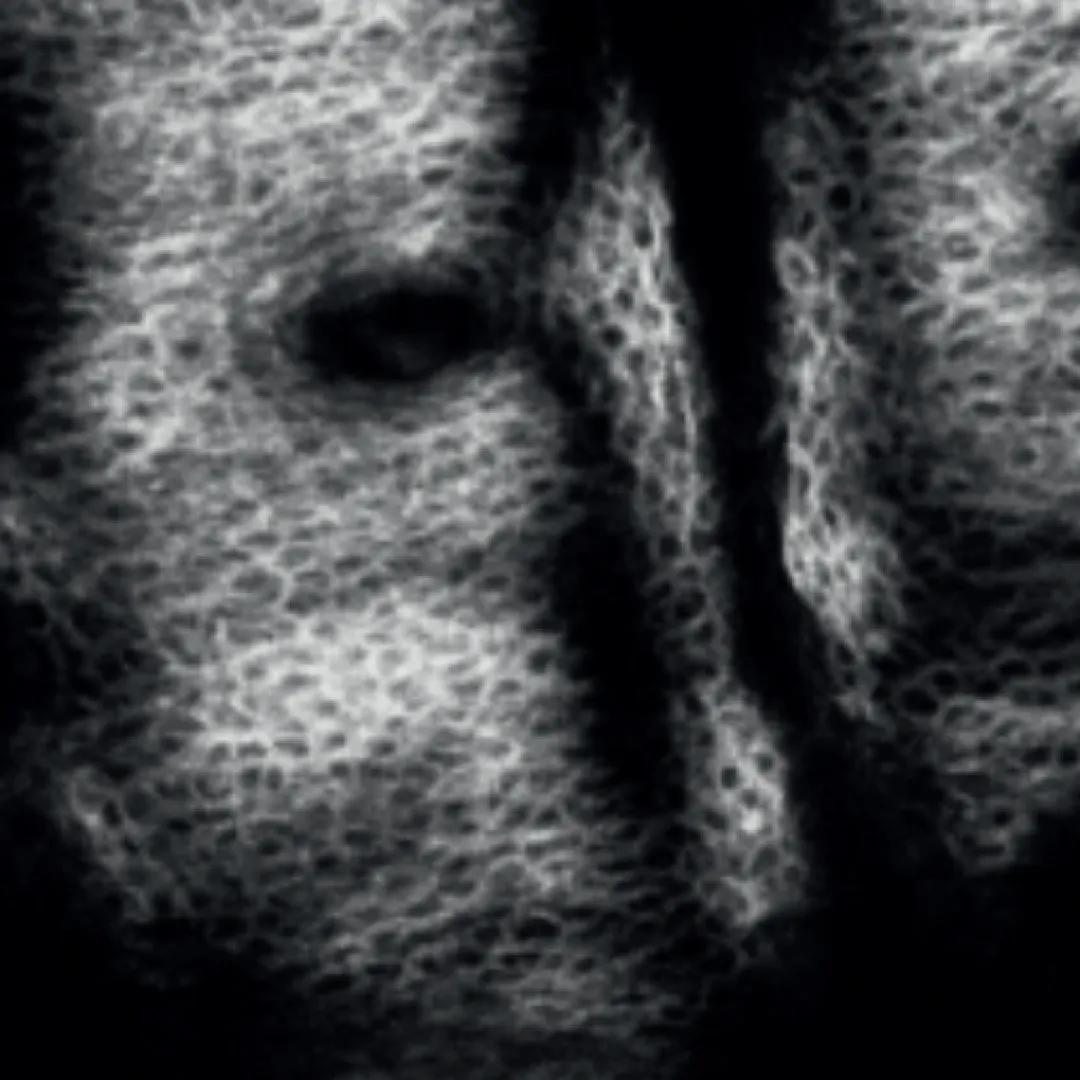 afterImage