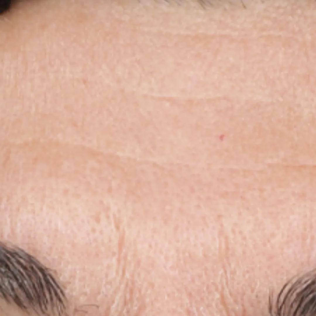 beforeImage