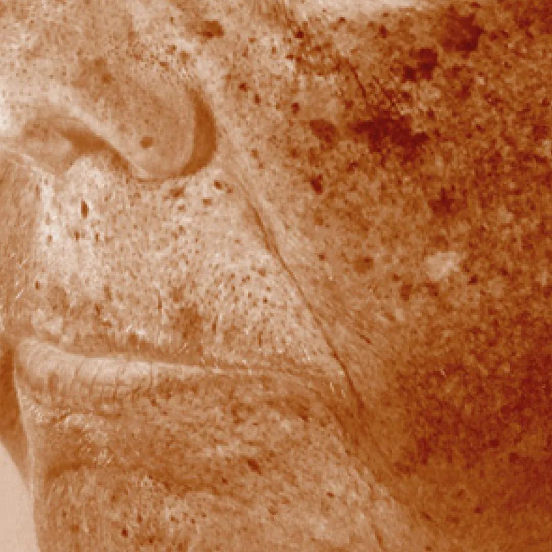 beforeImage
