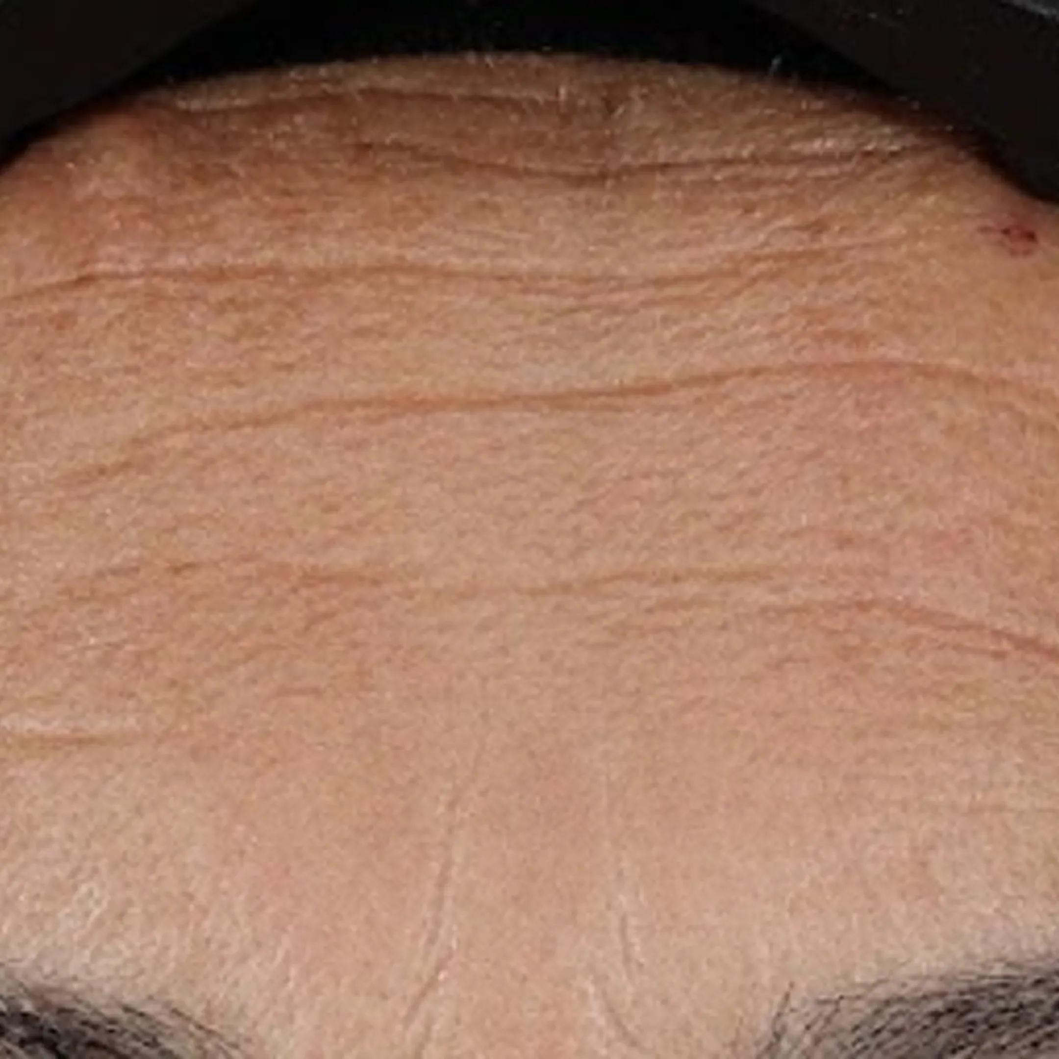 beforeImage