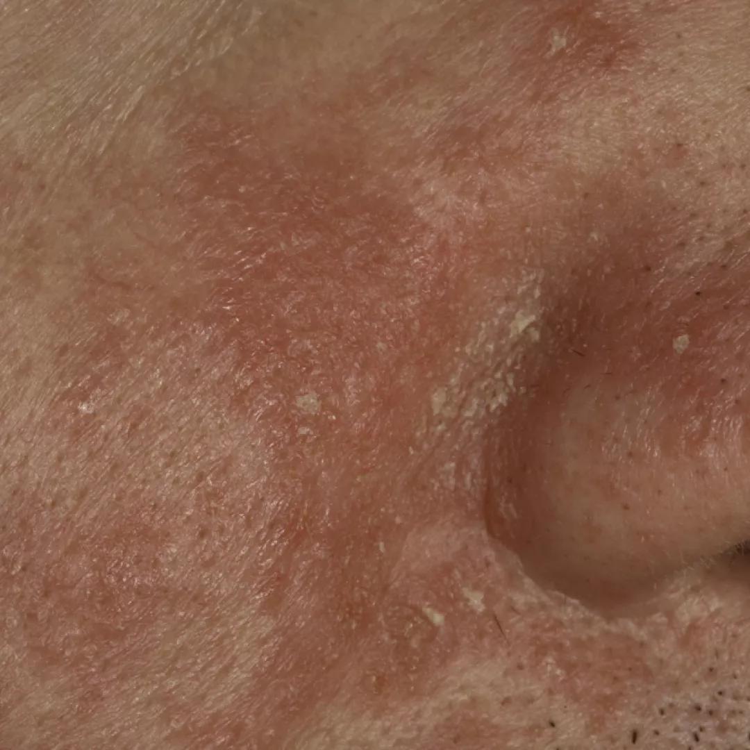 beforeImage
