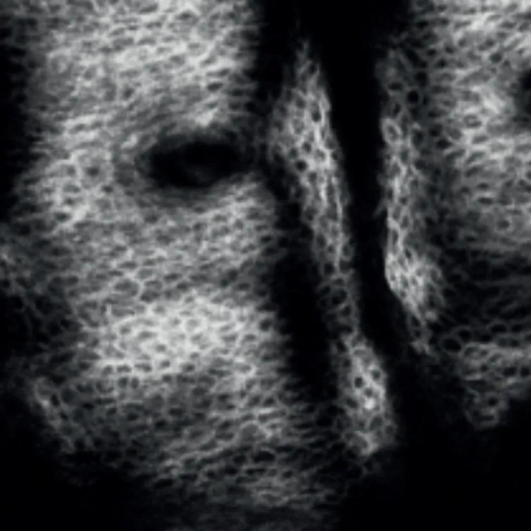 afterImage