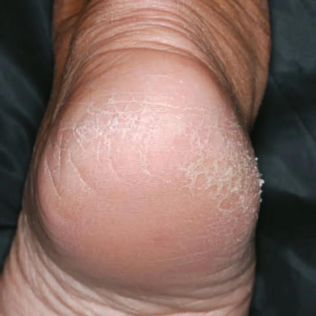 beforeImage