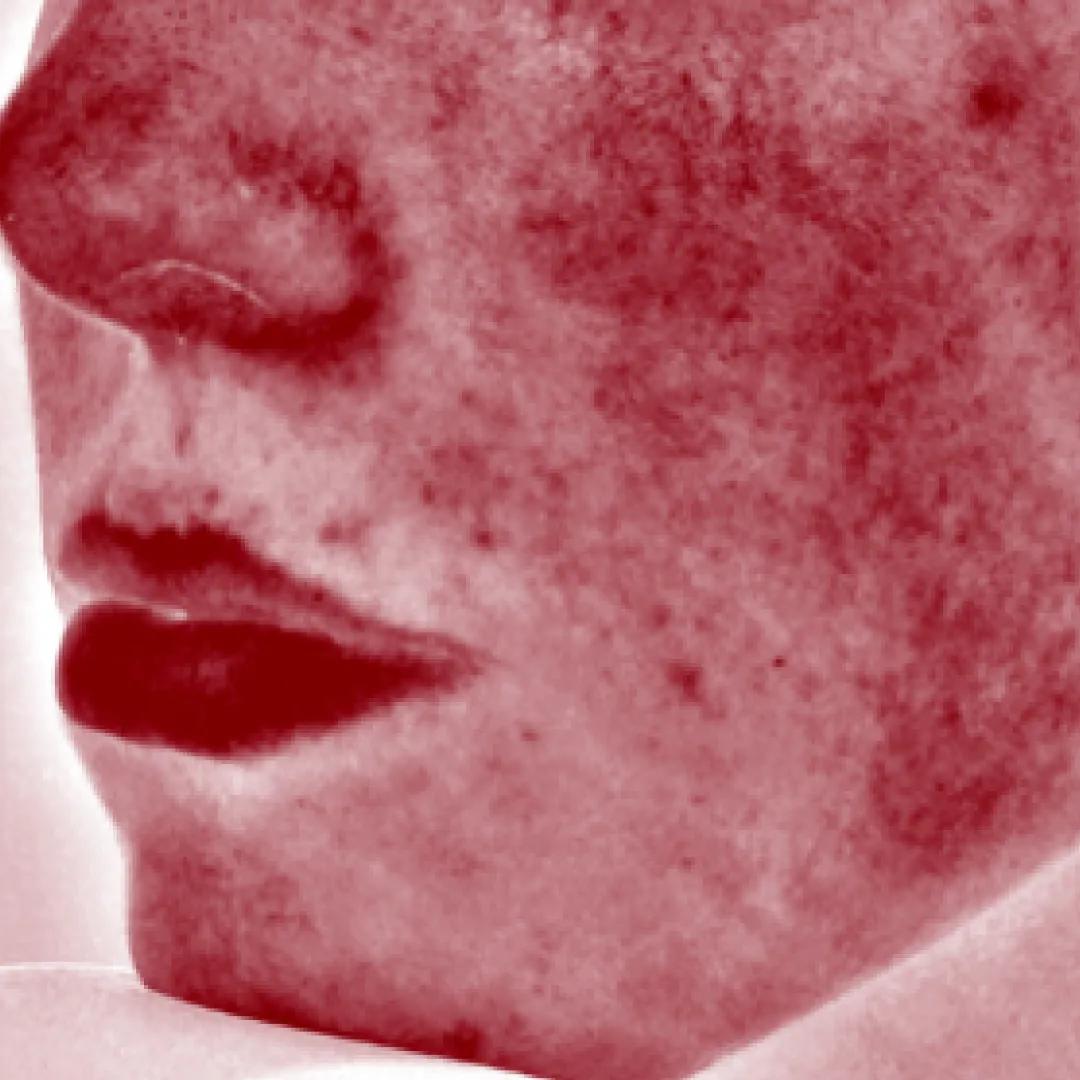 beforeImage