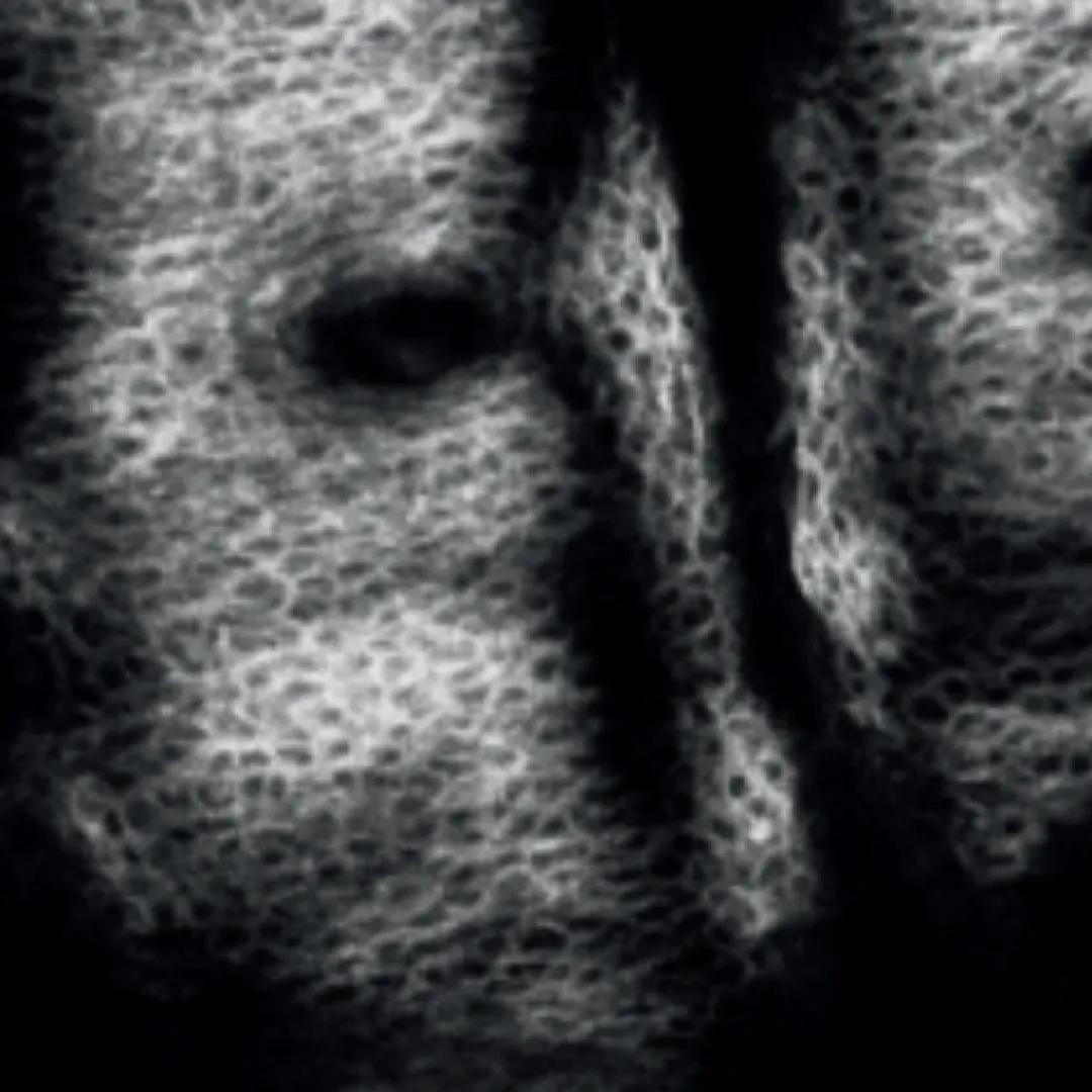 afterImage