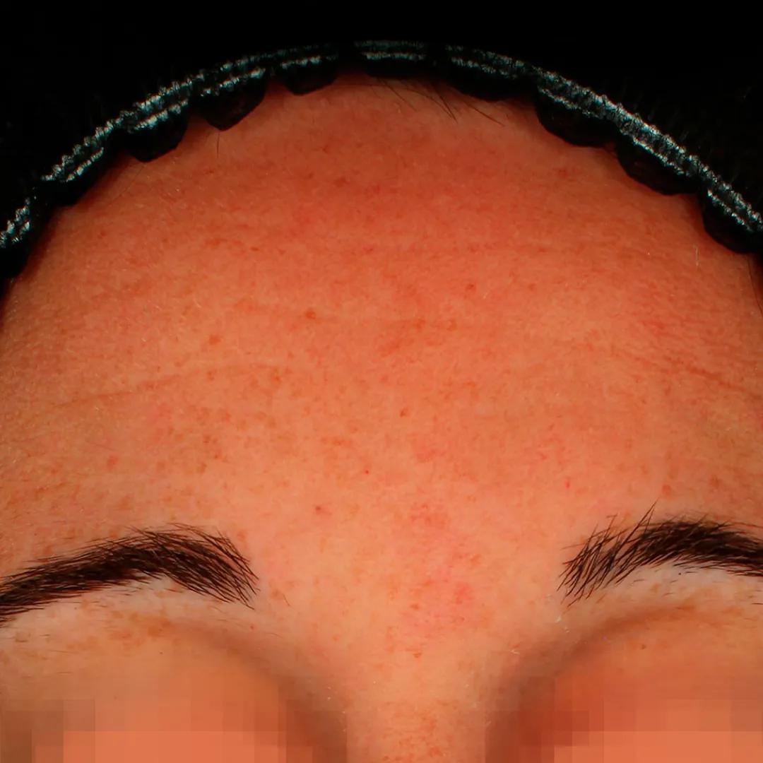 beforeImage