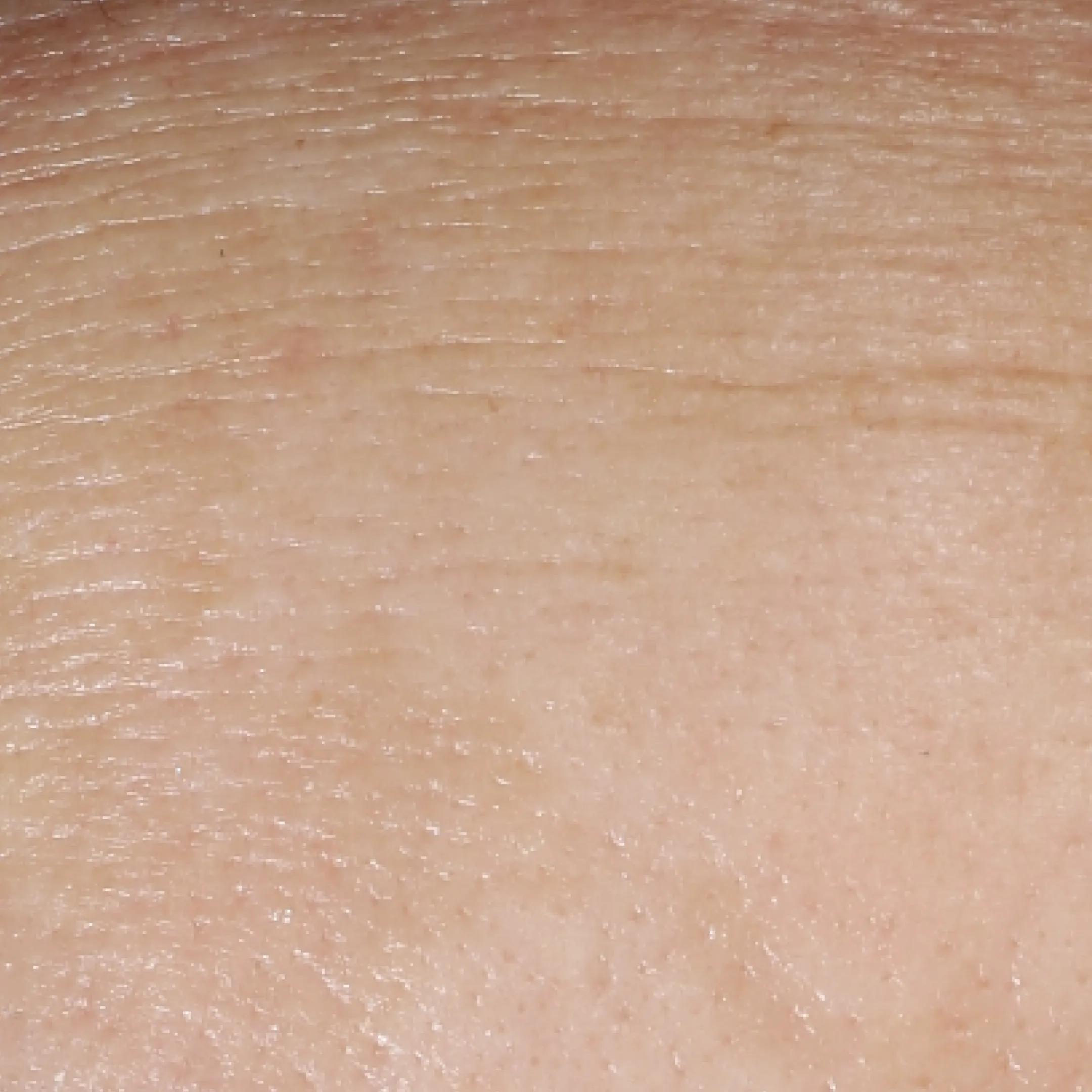 beforeImage