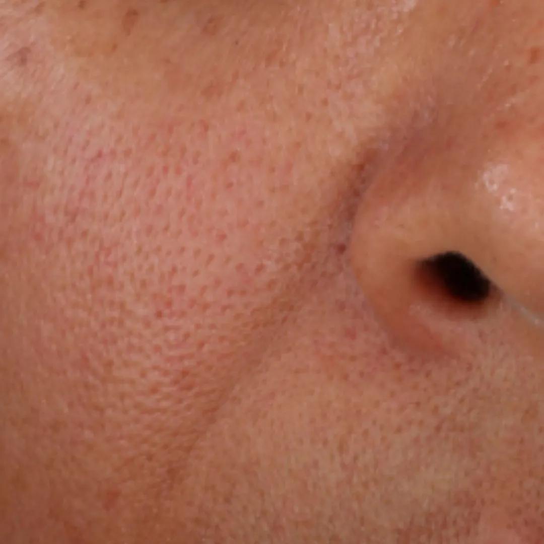 beforeImage
