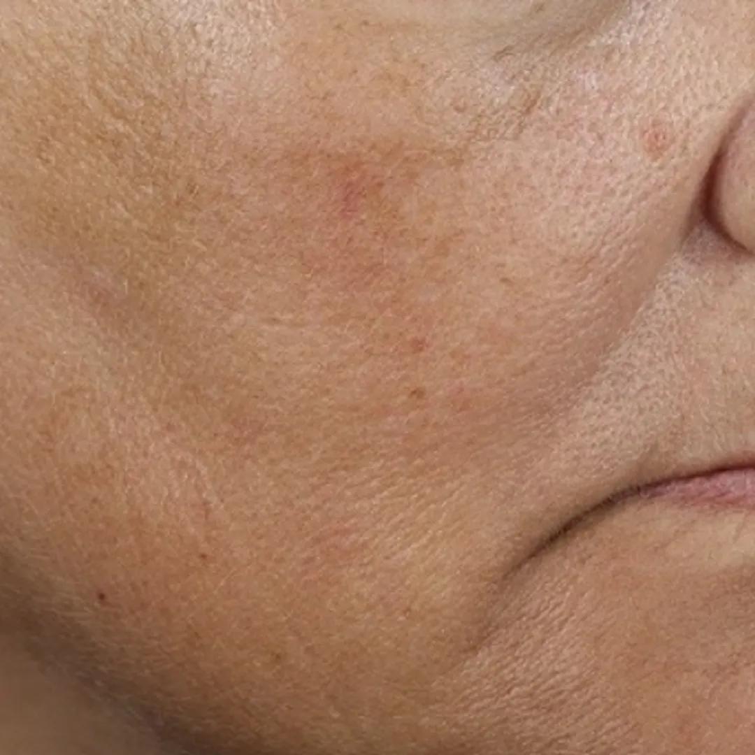 beforeImage