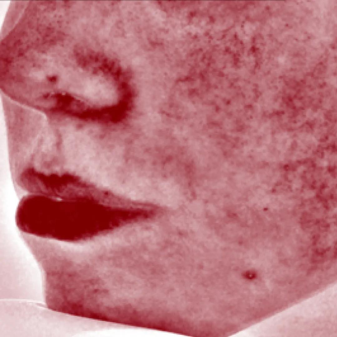 afterImage