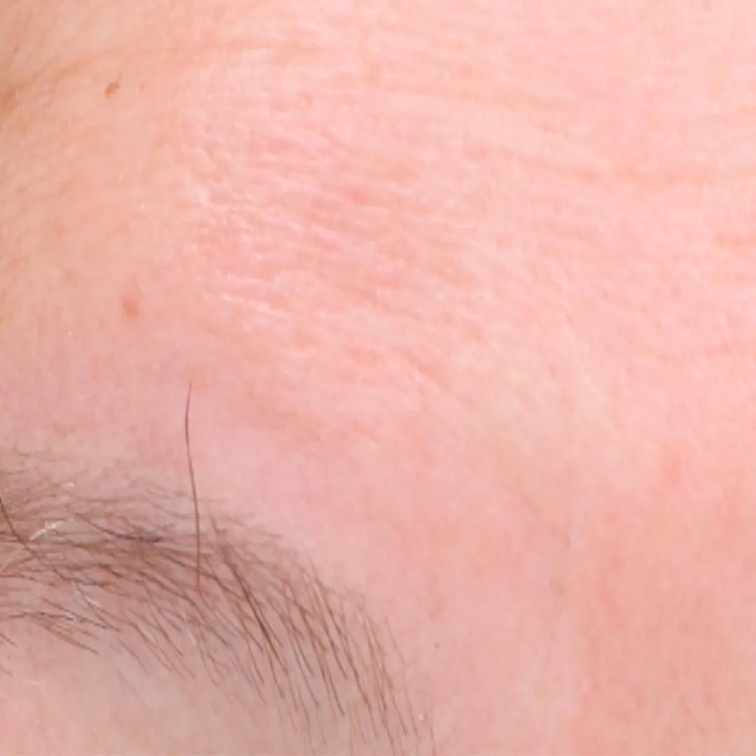 beforeImage