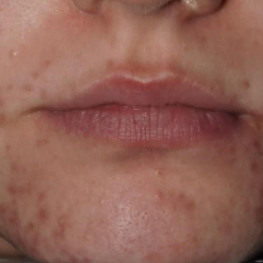 beforeImage