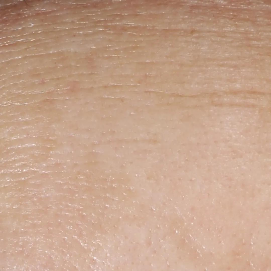 beforeImage