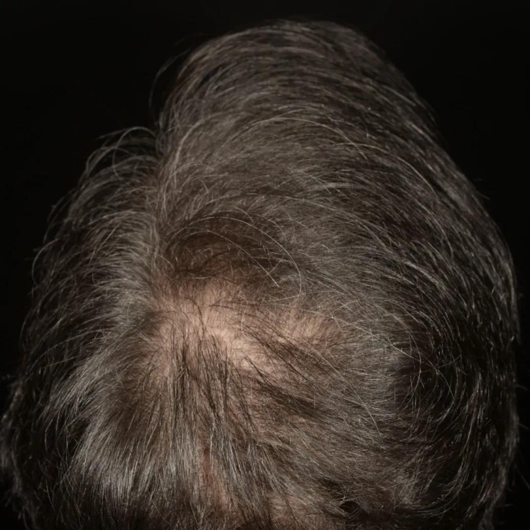 beforeImage
