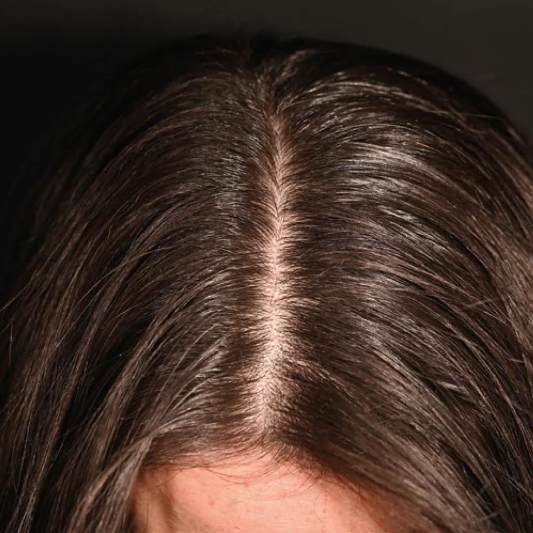 beforeImage