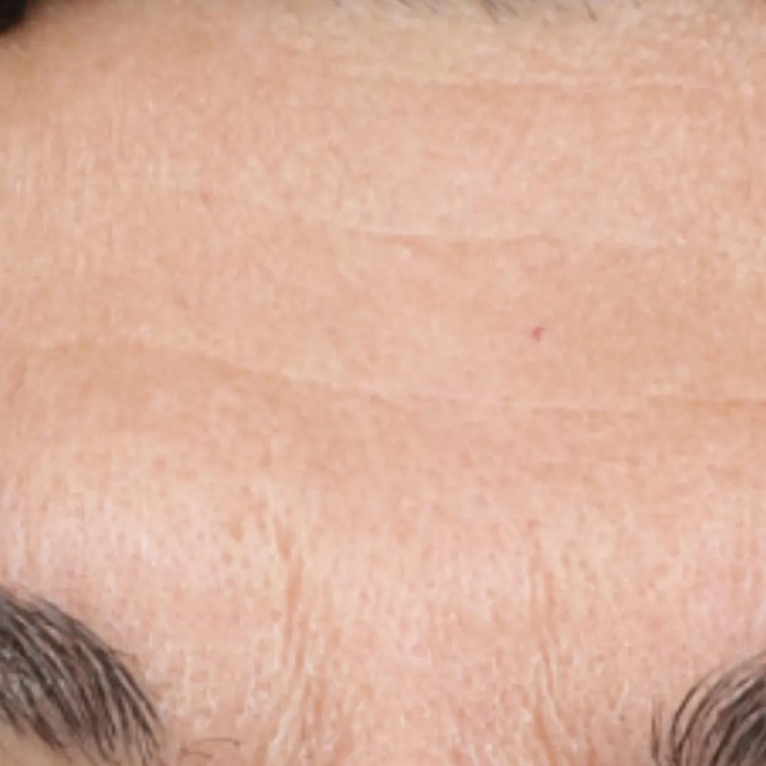 beforeImage