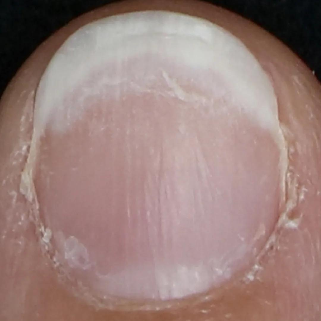 beforeImage