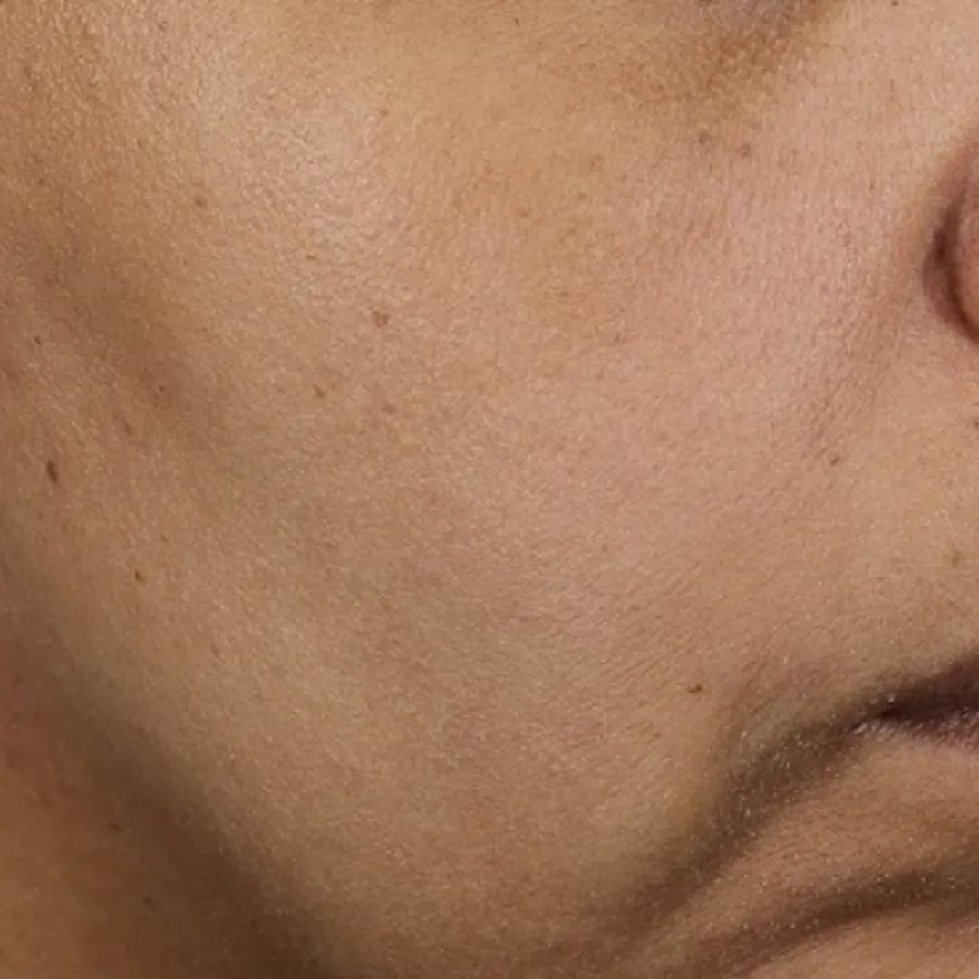 beforeImage