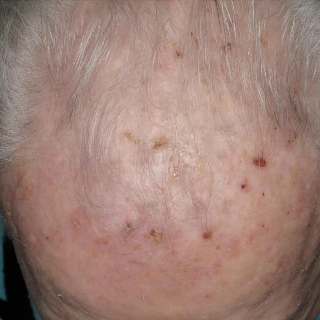 beforeImage