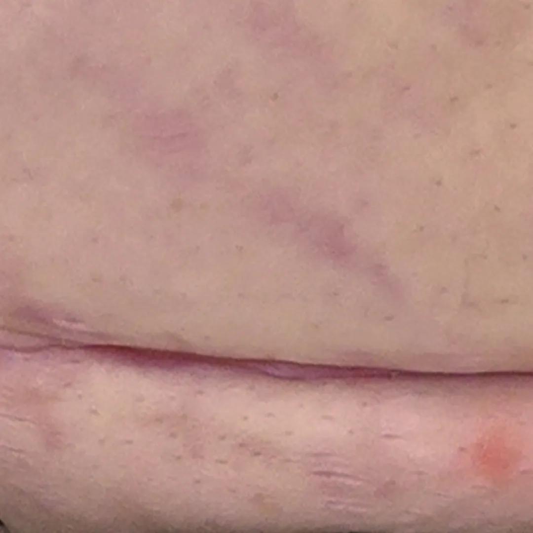 beforeImage