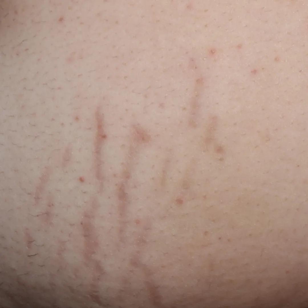 beforeImage