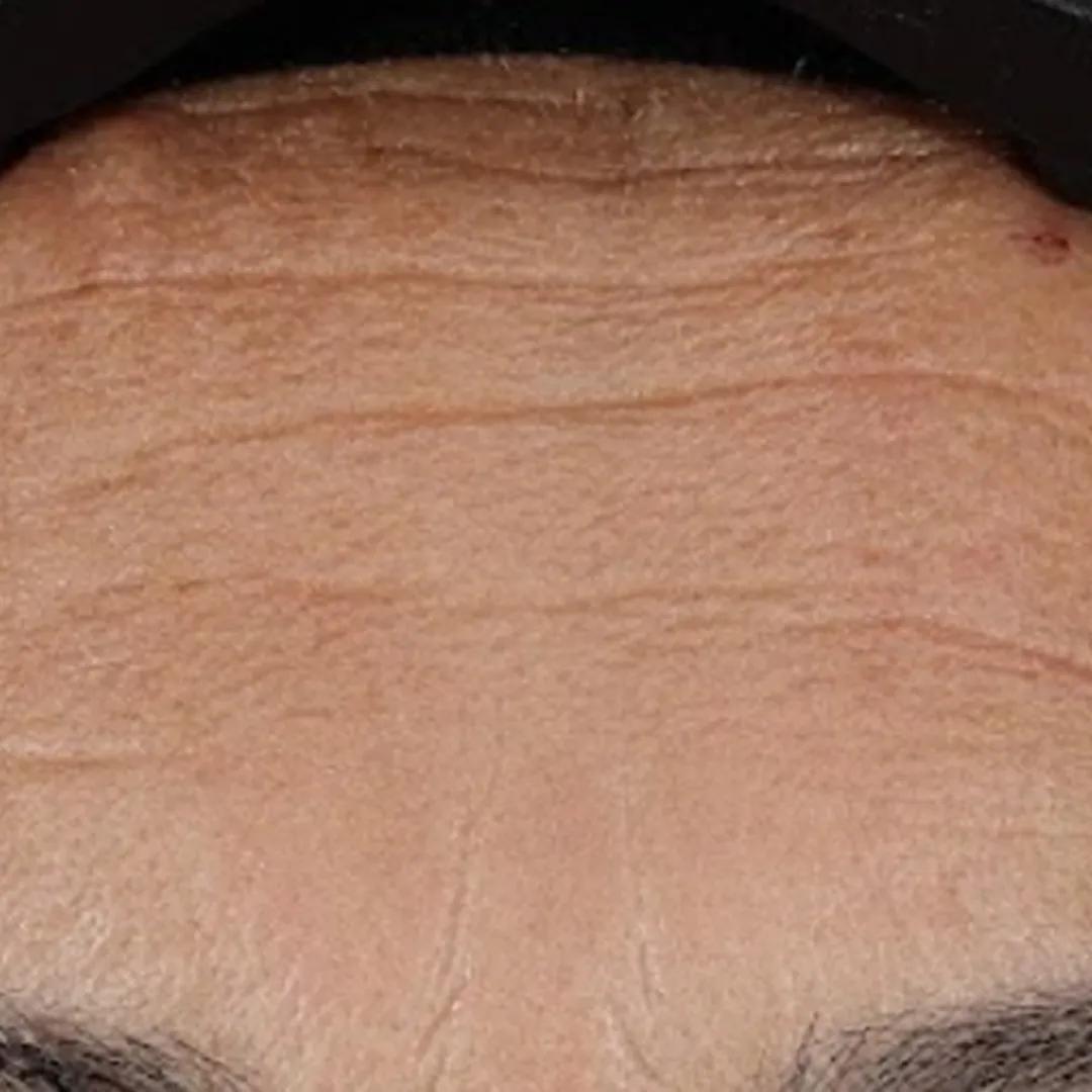 beforeImage