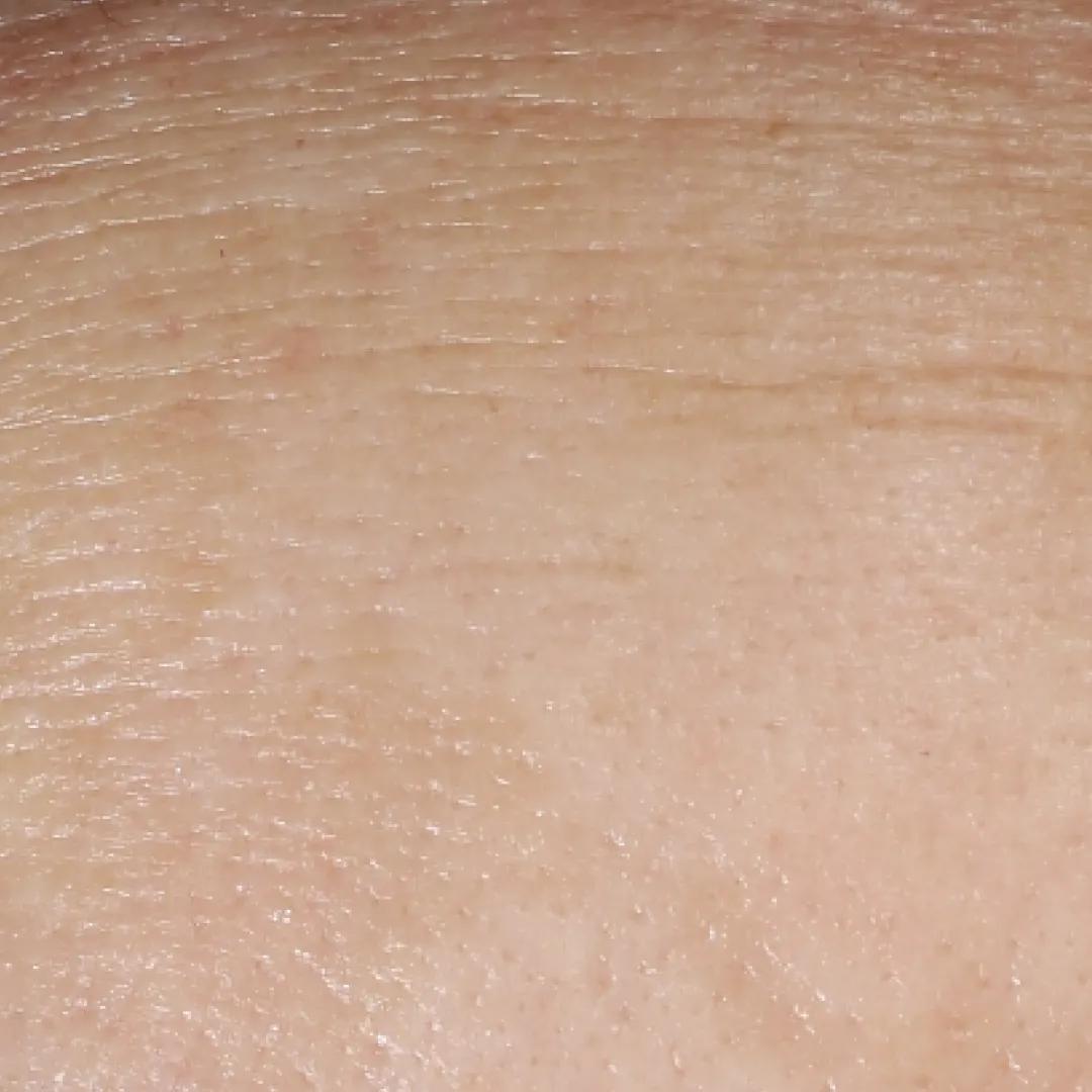 beforeImage