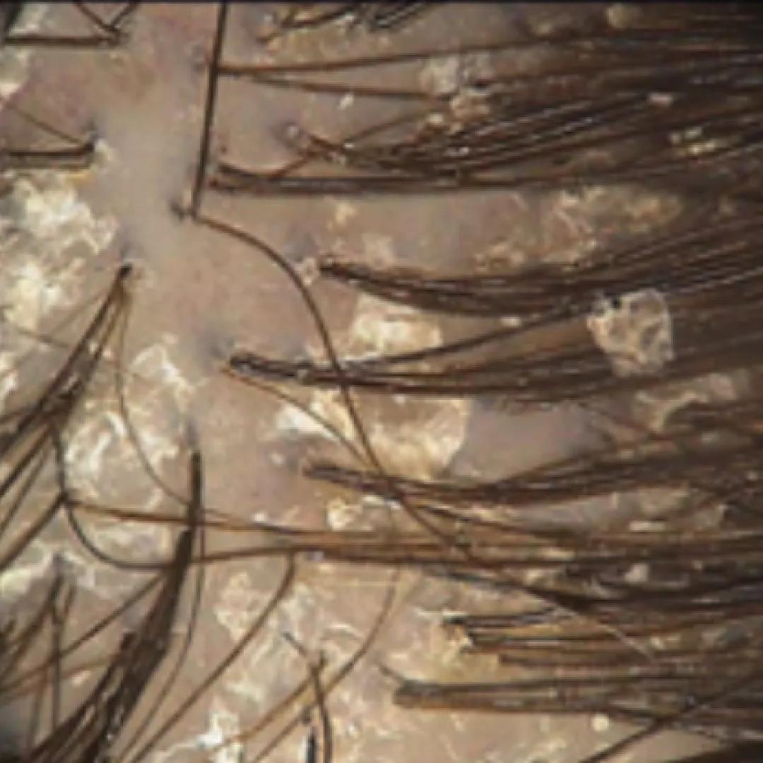 beforeImage